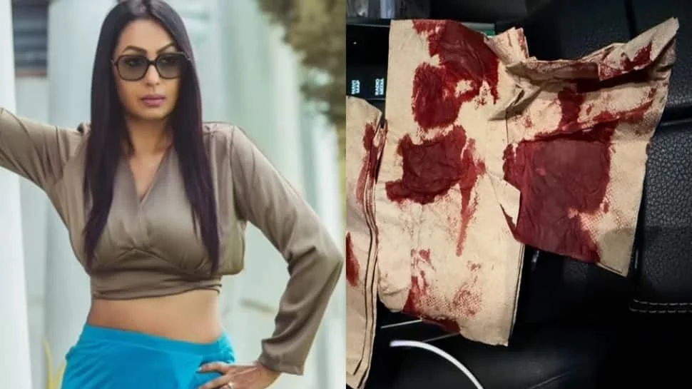 Actress Kashmera Shah Meets With Accident; Says Thank u god…